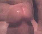 XchipnhardX